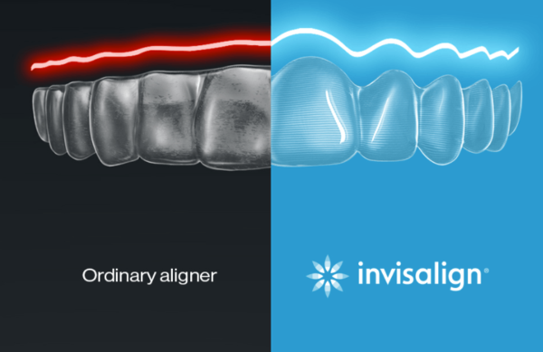 隱適美（Invisalign）