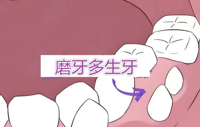多生牙 (1)