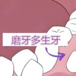 多生牙 (1)