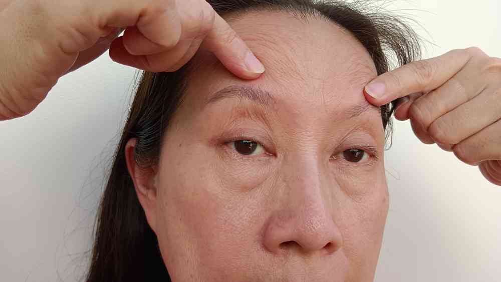 眼皮下垂